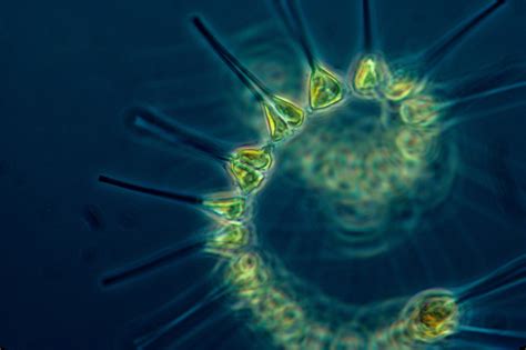  Yaginumaella - Unraveling the Secrets of This Microscopic Aquatic Houdini!